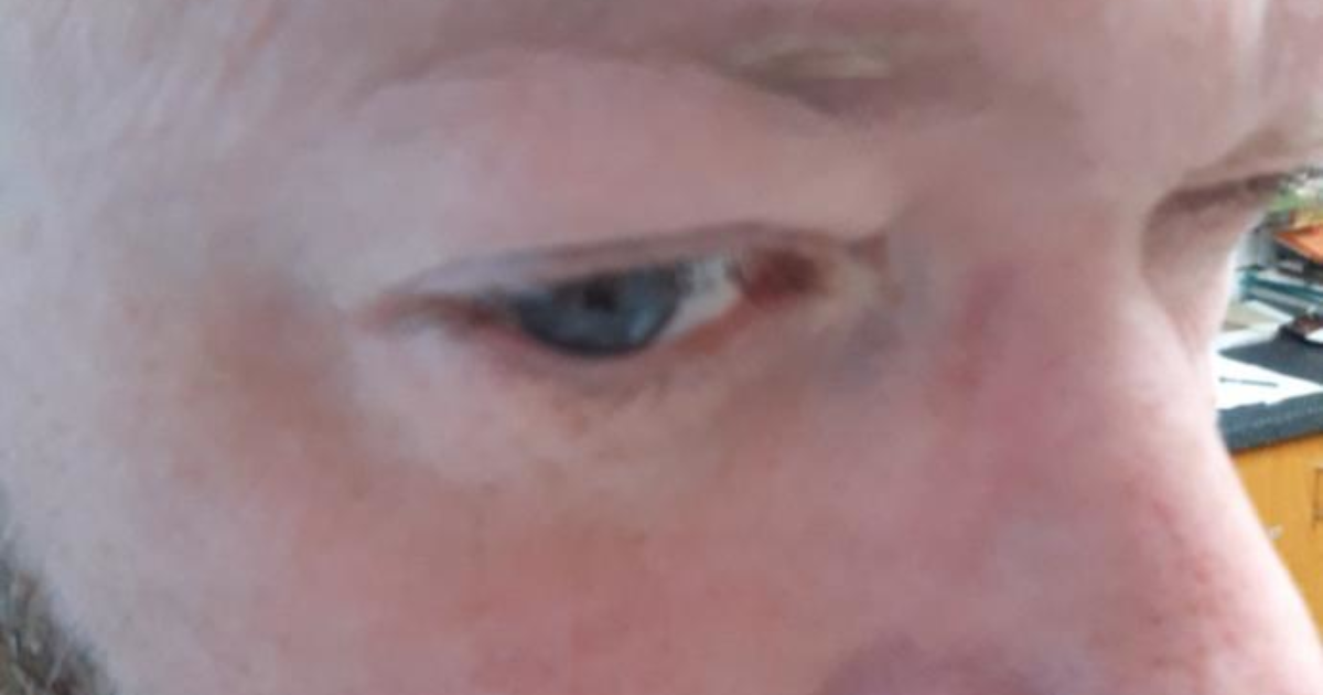 Finally! A Real Answer For Why Is My Face Always Red And Flushed - wllsxc4