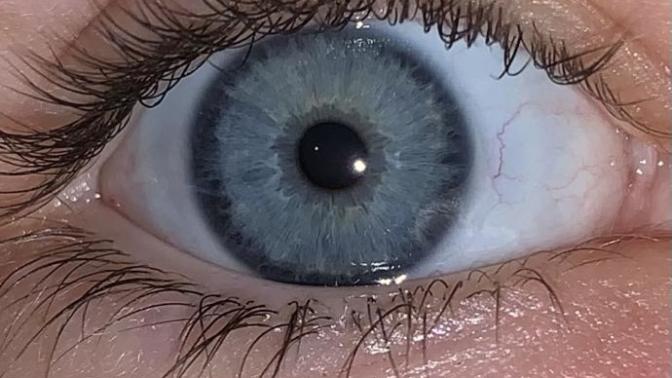 Post Your Eyes To Make A GaG Eye Color Gallery?