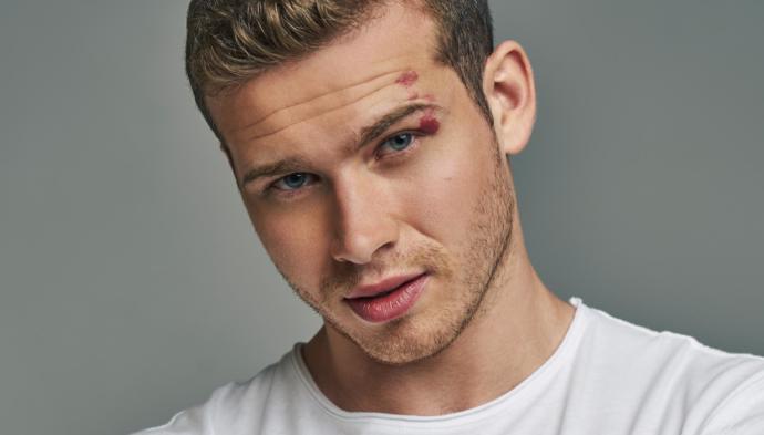 What are some physical flaws you find hot?