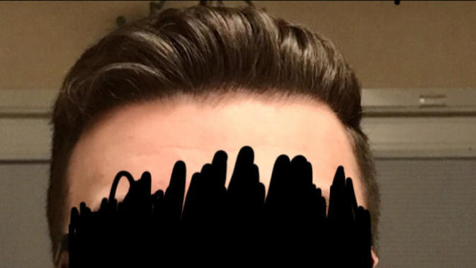 What hairstyle fits my face shape better?