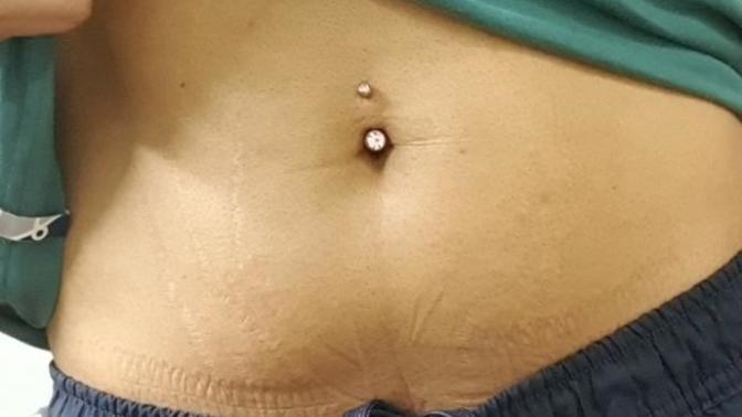 Are guys and navel piercings a thing?