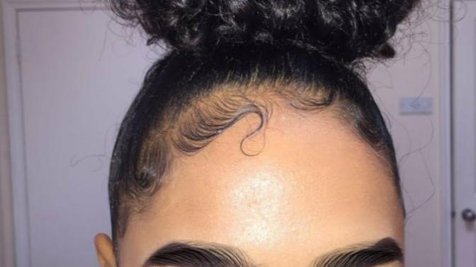 Are BIG Foreheads A Turn Off Or A Dealbreaker For You In A Relationship?