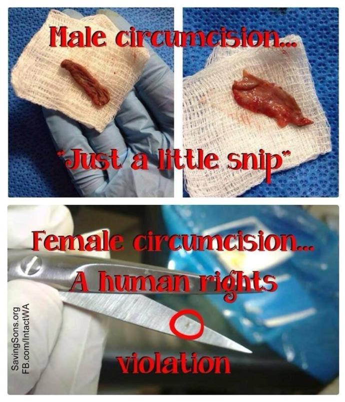 Is Female circumcision the same as male circumcision?