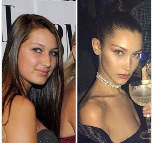 Guys, what do you think of girls that get plastic surgeries done?
