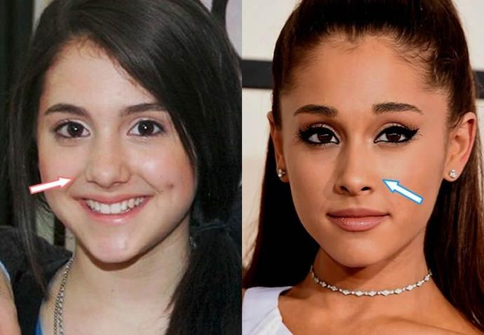Guys, what do you think of girls that get plastic surgeries done?