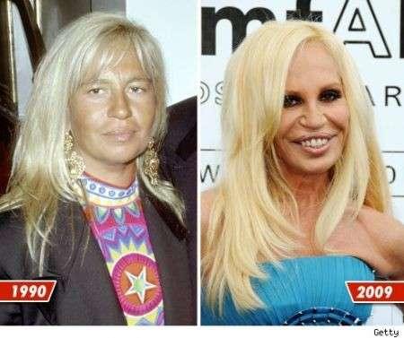 Guys, what do you think of girls that get plastic surgeries done?
