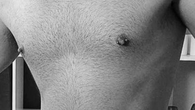 Closely trimmed coarse hairs?