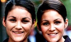 After what age do you think people (of the opposite gender) start to become less attractive?