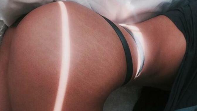 Guys, What Do You Think About Stretch Marks?