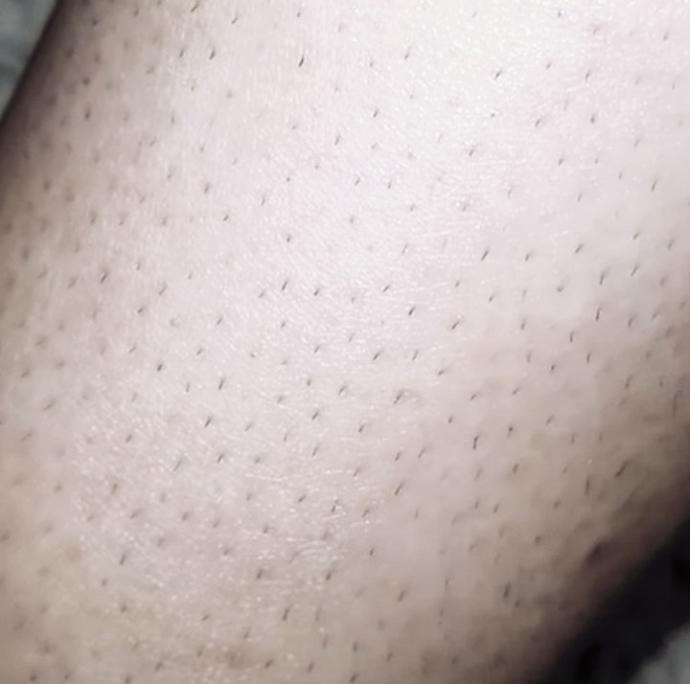 Girls, Do like if a man has hairy legs and still wears shorts?