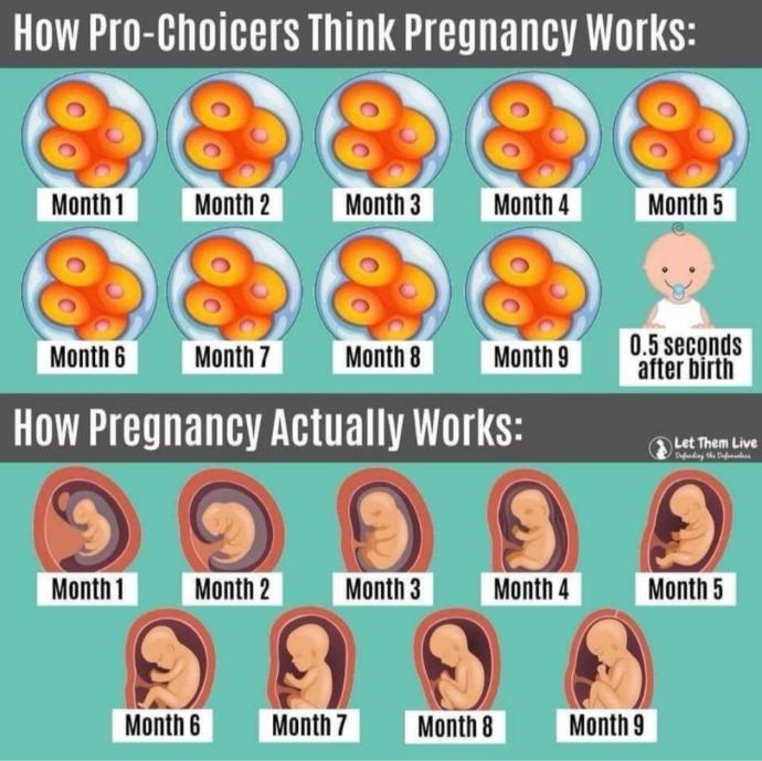 Is abortion the right move?