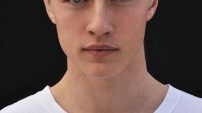 My dream was and will be to pursue modelling as a proffession, it was my dream for about 18yrs, I will pursue. BUT. I have acne? Help me, will u?