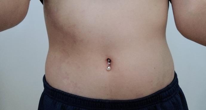Should I get a belly button piercing?