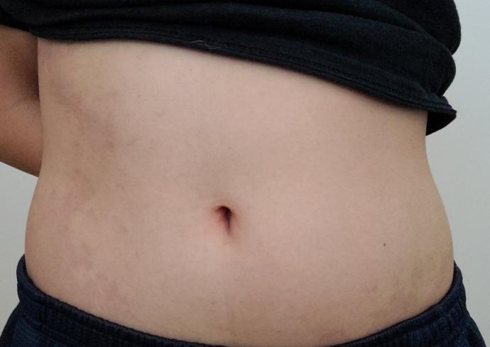 Should I get a belly button piercing?