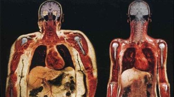 How would your life change if instead of seeing people's outer layer of skin, you could only see what was below it?