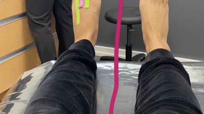 Are ugly feet on a woman a dealbreaker?