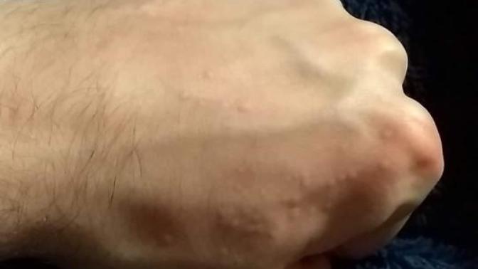 Wtf going on with my hand?