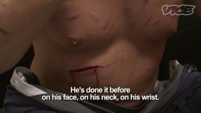 Ladies do you find men with self harm scars attractive?