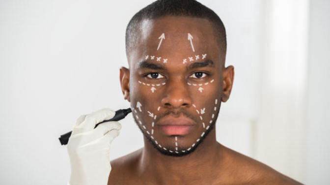 If plastic surgery was cheap and painless, would you consider getting it?