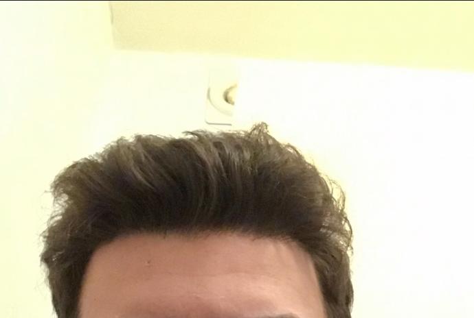 Before