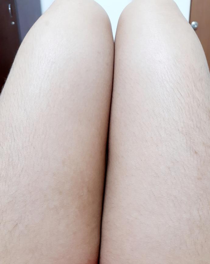 Guys, Whats your opinion on women with hairy thighs?