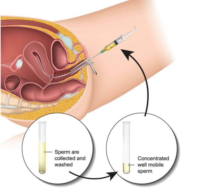 Is it rude to refer to certain babies as “test tube kids” (read more below)?