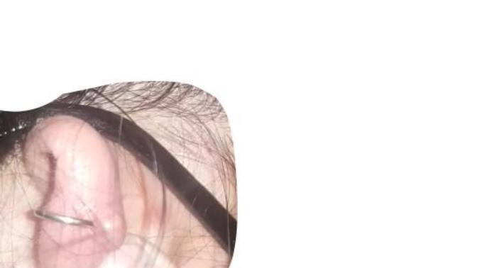 NEED HELP ON PIERCINGS AND KELOIDS?