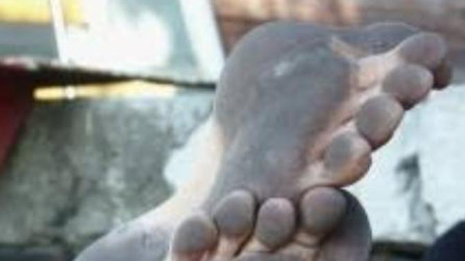 Why do idiots think walking around the city ( or public places in general) barefoot is risky when it ' s perfectly safe, healthy and much more normal?