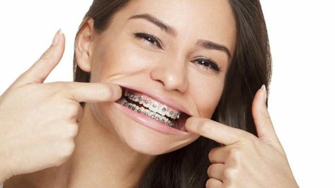 Would you date someone who wears braces?