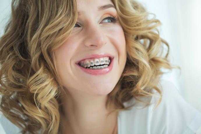 Would you date someone who wears braces?