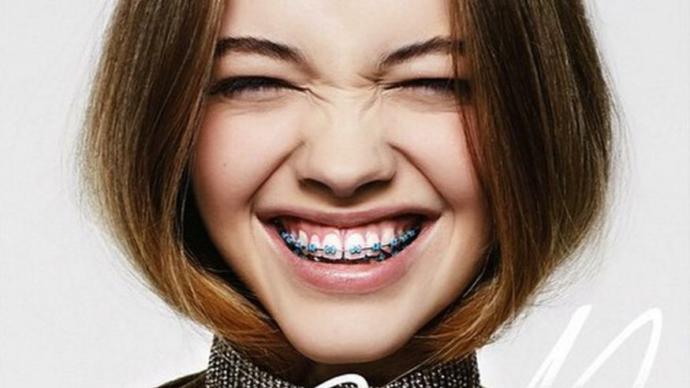 Would you date someone who wears braces?