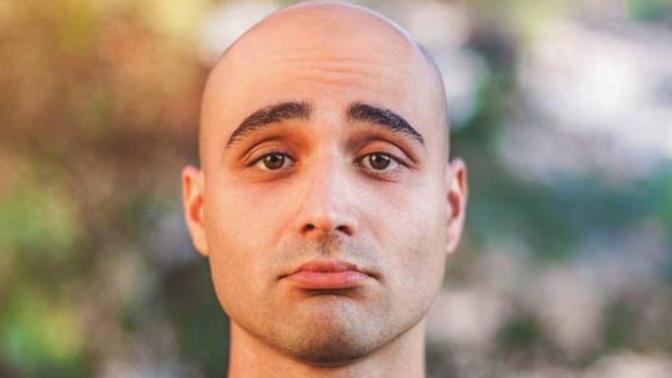 Ladies, primarily between 18 and 25, what's your take on bald guys?