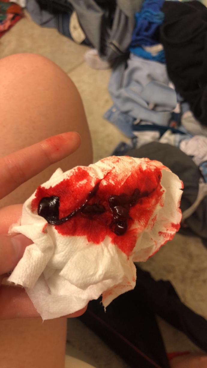 Was this a miscarriage?