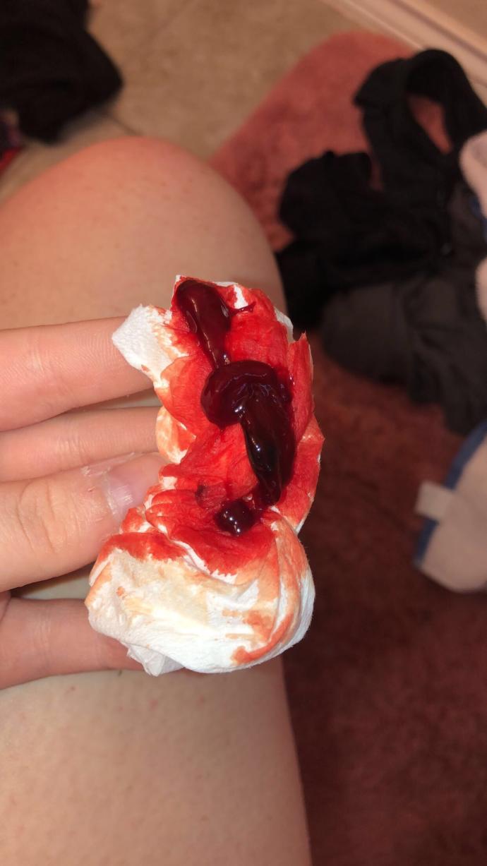 Was this a miscarriage?