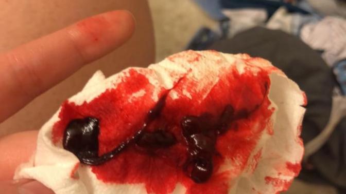 Was this a miscarriage?