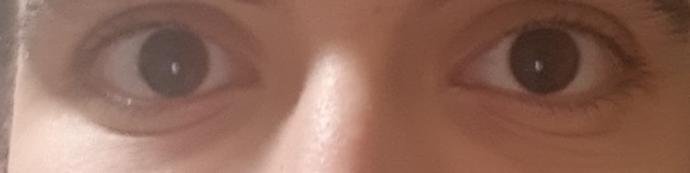Do I have wrinkles?