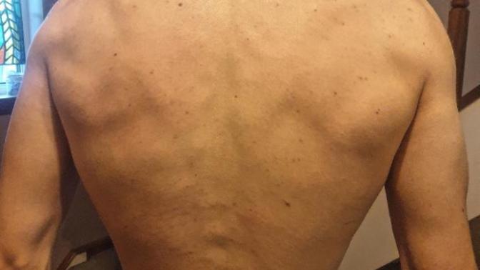 How to improve my back?