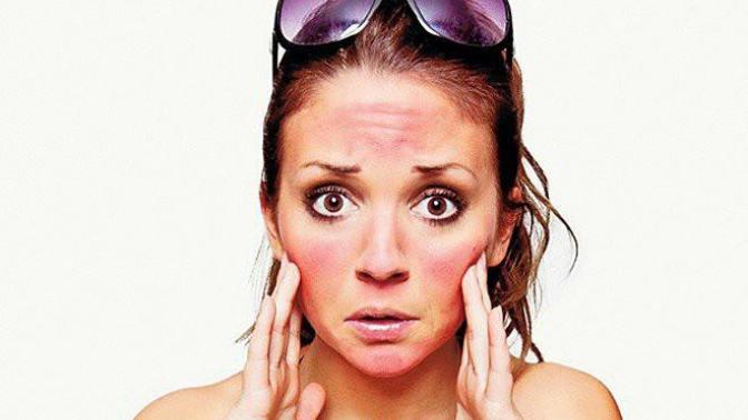 What is the worst sunburn you've ever had?