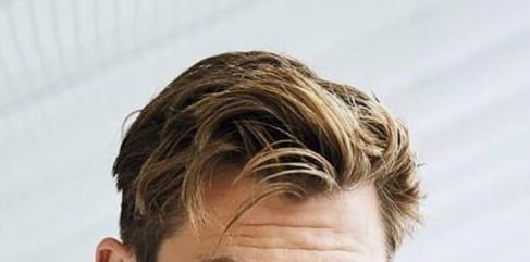 Should I style my hair like these guys if im receding in the corners or just shave it?