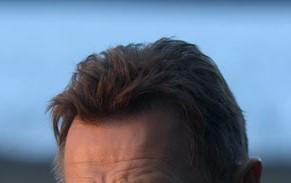 Should I style my hair like these guys if im receding in the corners or just shave it?