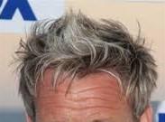 Should I style my hair like these guys if im receding in the corners or just shave it?