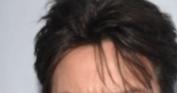 Should I style my hair like these guys if im receding in the corners or just shave it?