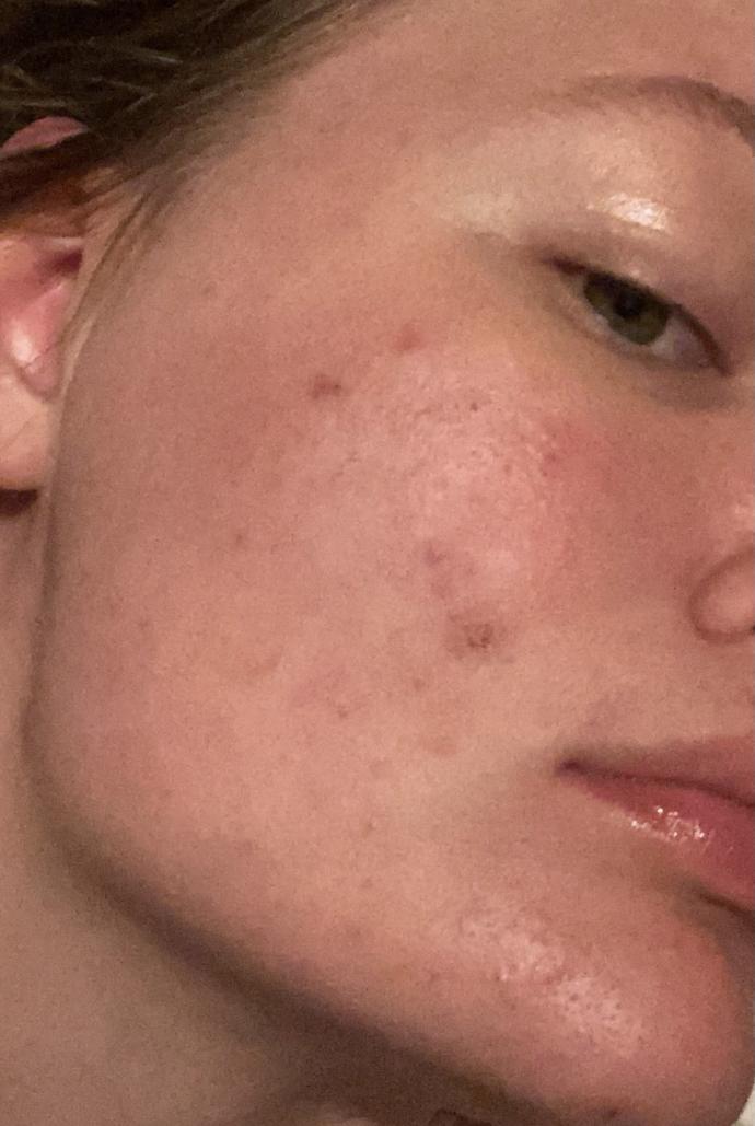 What’s your skincare routine?