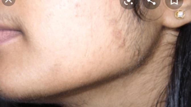 What do you think girls with natural hair near her jaw and moustache?