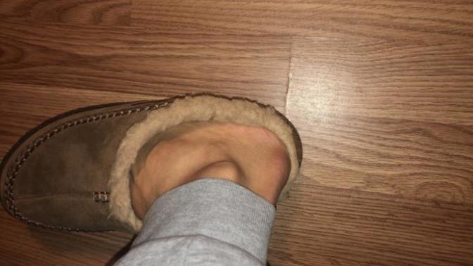 Can Ugg slippers be worn outside?