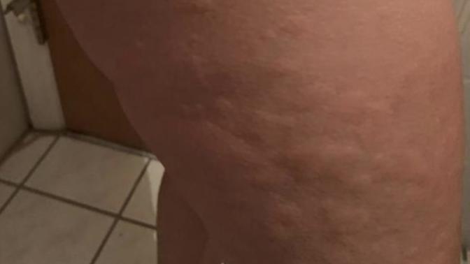 Has anyone ever been through an allergy like this?
