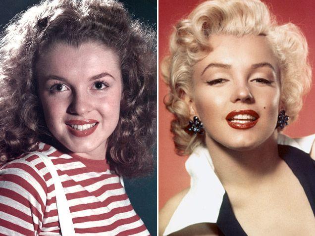Marilyn before surgery