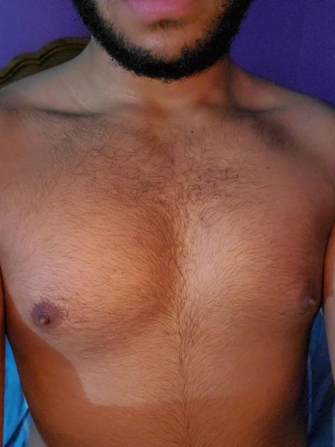 Girls, I heard only grandmothers like hairy chests, but I am 16. Is chest hair a no no for attracting teenagers?