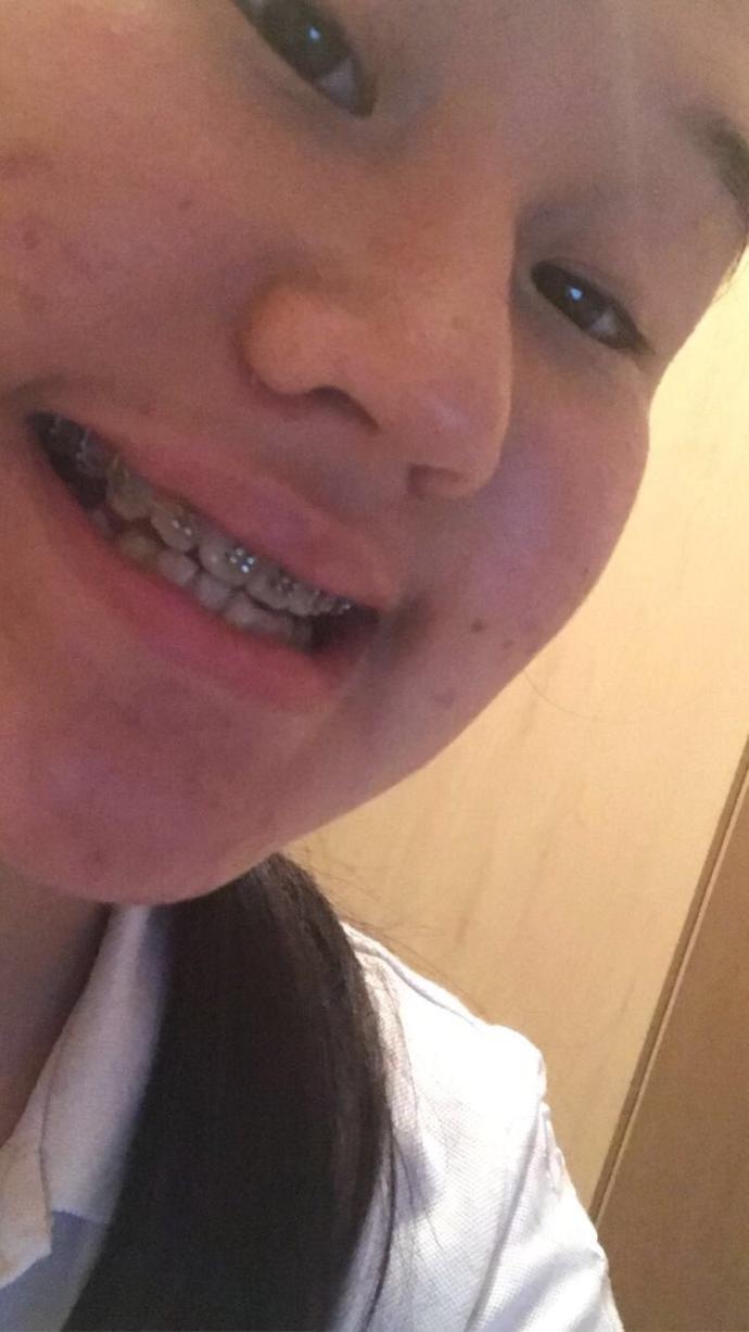 Do you think crooked teeth are ugly?