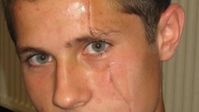 Ladies do you find my facial scar attractive?